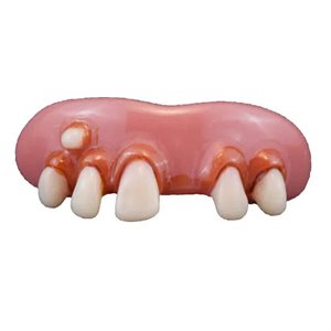 Billy-bob deliverance denture with thermoplastic beads