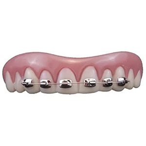 Billy-bob braces denture with thermoplastic beads
